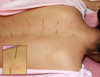 $Bo*$,;I$5$C$?GXCf$NMM;R(B